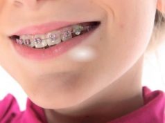 вирівнювання зубів у дітей