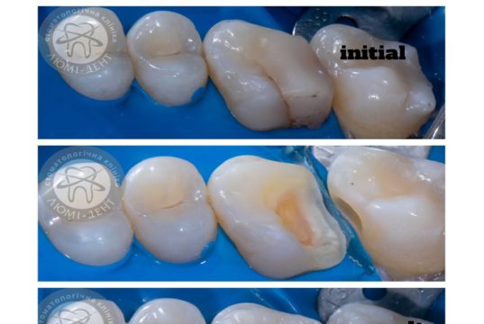 стоматологія в Києві