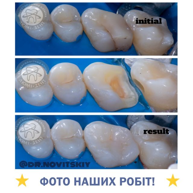 стоматологія в Києві