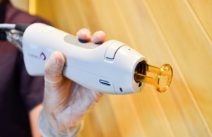 Корисність лікування пікосекундним імпульсним олександритовим лазером невуса Ота