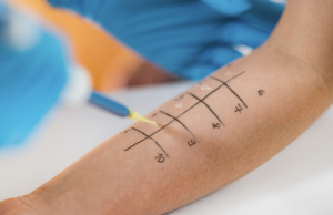 Понад 12000 випадків алергії зафіксували на Львівщині за минулий рік