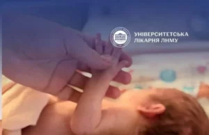 Історія недоношеної Анни, яка народилася на 28 тижні у львівській клініці Історія недоношеної Анни, яка народилася на 28 тижні у львівській клініці