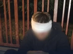 У Львові патрульні надали домедичну допомогу чоловікові з травмою голови У Львові патрульні надали домедичну допомогу чоловікові з травмою голови
